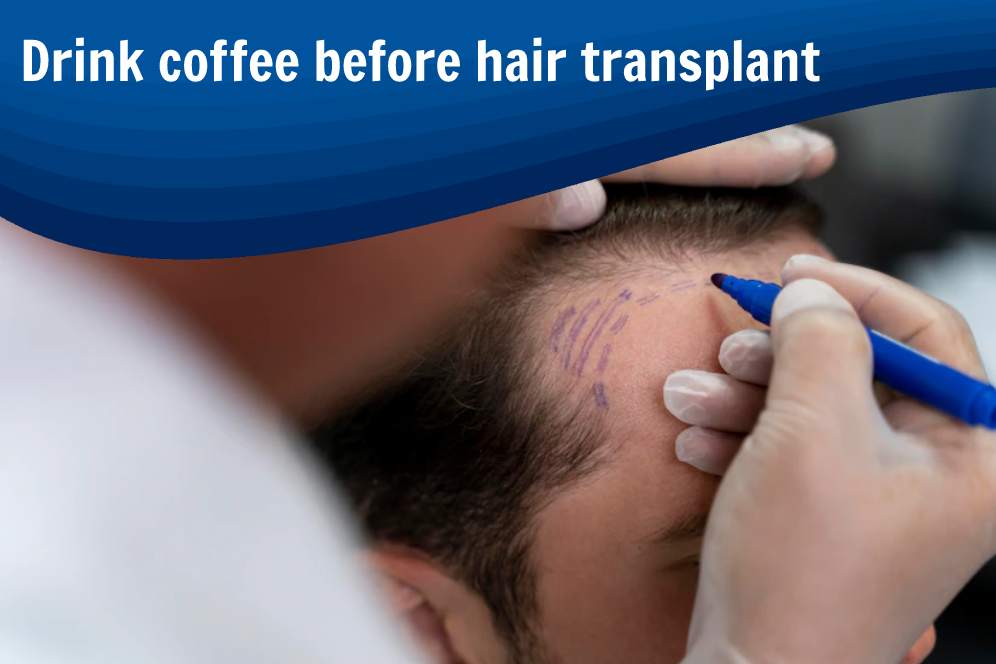 Drink coffee before hair transplant