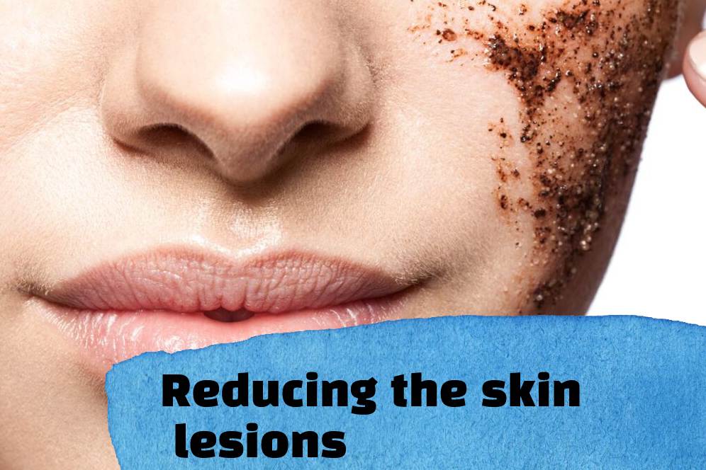 Reducing the skin lesions