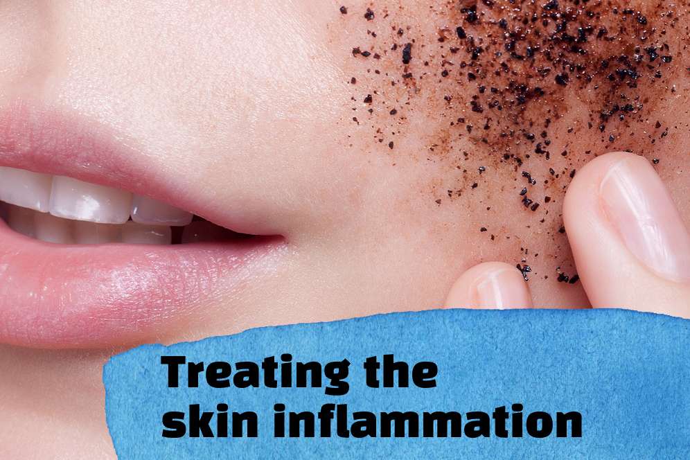 Treating the skin inflammation